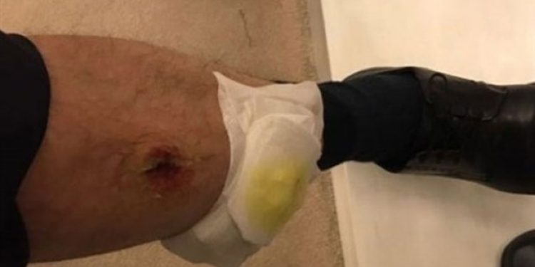 Adli Tıp Uzmanı o yarayı inceledi