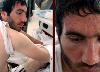 İşkenceye ‘çözüm süreci’ savunması