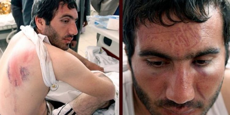 İşkenceye ‘çözüm süreci’ savunması