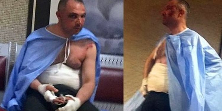 İşkenceyi neden alenen yapıyorlar