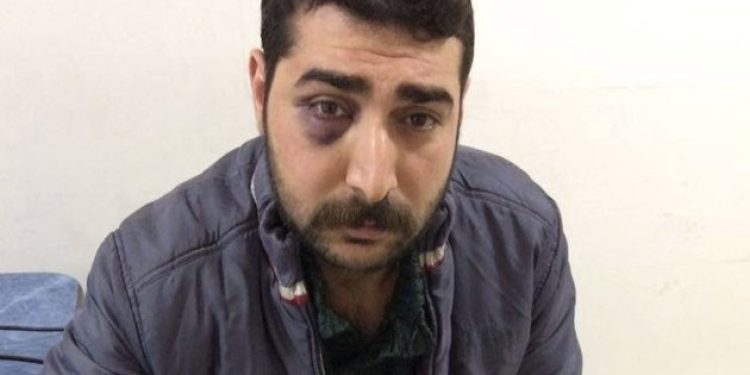 Gazeteci Yıldız’a gözaltında işkence yapılmış