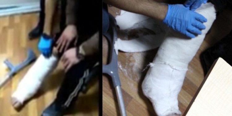 Bacağındaki alçıdan bakın ne çıktı?