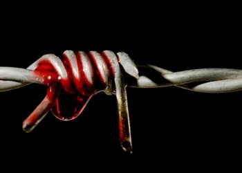 AKP’nin işkence üssünde yeni skandal!