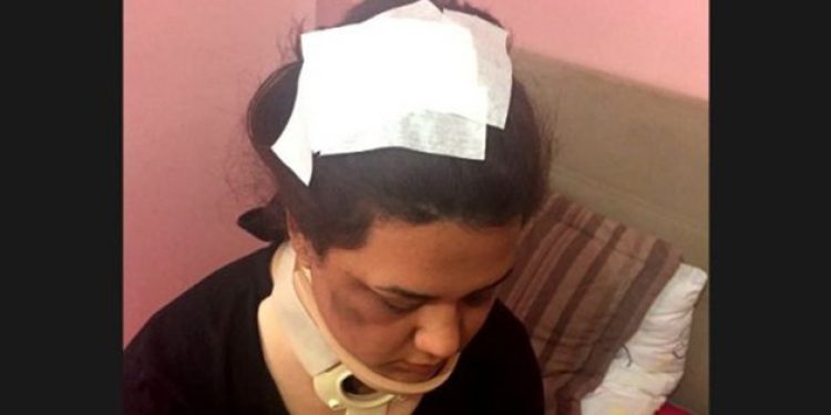 AKP’lilerin linç ettiği kadınlar konuştu