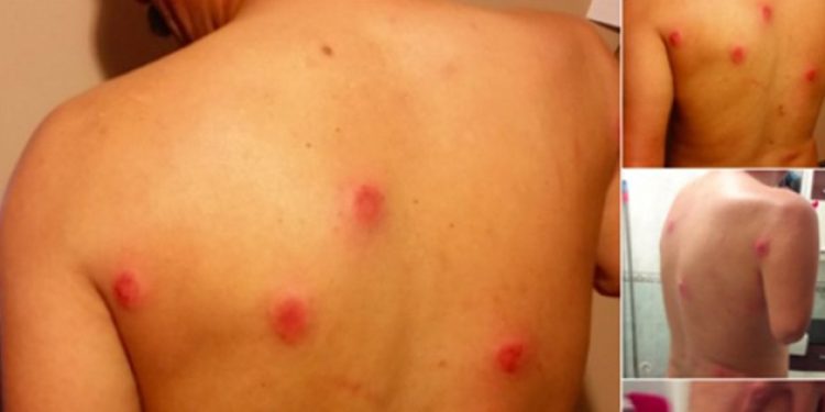 İşini istedi, polis plastik mermiye boğdu!