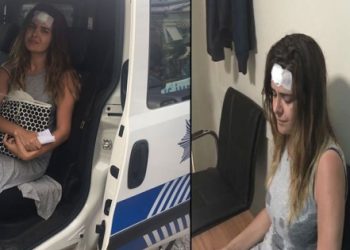 Ünlü sunucuya ‘taciz’ dehşeti: Alnından yaralandı