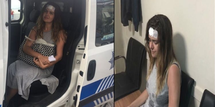 Ünlü sunucuya ‘taciz’ dehşeti: Alnından yaralandı