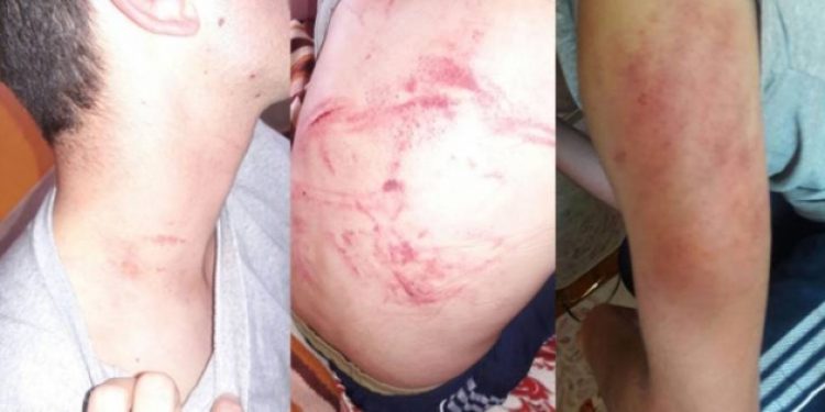 Tugayda bonzai içip işkence yaptılar