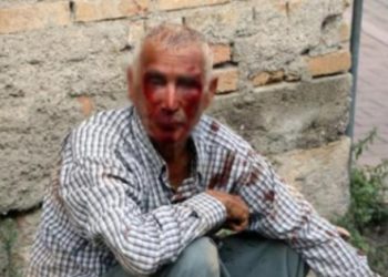 ​Karpuz bekçisini öldüresiye dövüp parasını gasp ettiler
