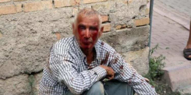 ​Karpuz bekçisini öldüresiye dövüp parasını gasp ettiler