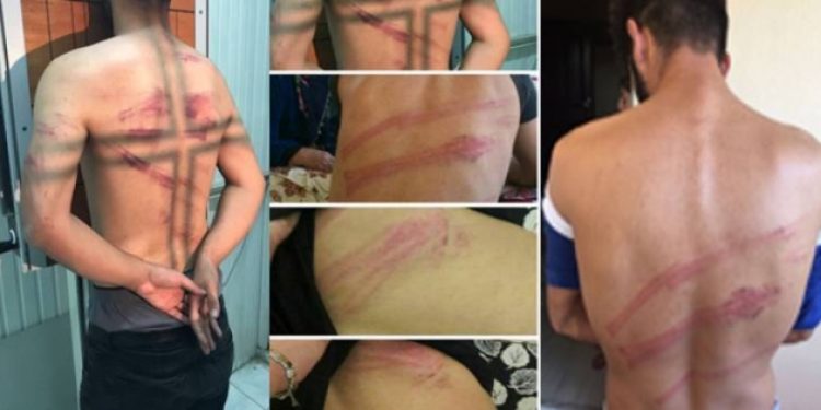 İşkence gören köylülere bir de doktor işkencesi