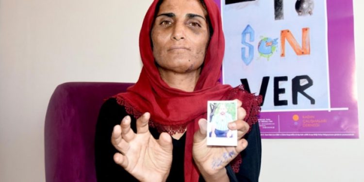 Eşinden gördüğü işkenceden ötürü 11 parmağı kesilen kadın: Cezasını çeksin