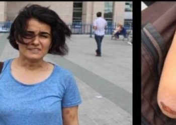 İnsan hakları savunucularına toplu işkence