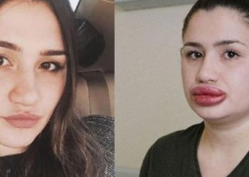 “Sahte estetikçi” kuaför cezaevinden kaçtı