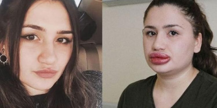 “Sahte estetikçi” kuaför cezaevinden kaçtı