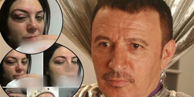 Mustafa Topaloğlu dövdüğü eşiyle barıştı
