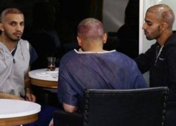 ​”Yoldan adam çevirip saç ekiyorlar!”