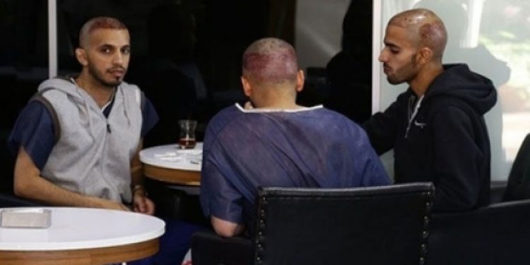 ”Yoldan adam çevirip saç ekiyorlar!”