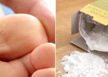 Sadece 1 günde nasırı yok ediyor!