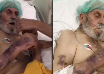 Yoğun bakım hastasına sigara verdiler