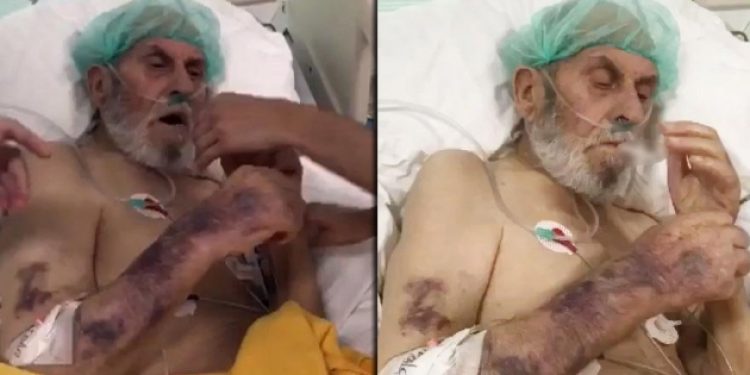 Yoğun bakım hastasına sigara verdiler
