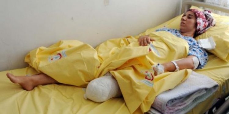 Eşinin işkencesi nedeniyle önce bacağını, sonra bebeğini kaybetti!