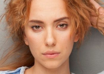 Duygu Sarışın’ın yüzü yandı