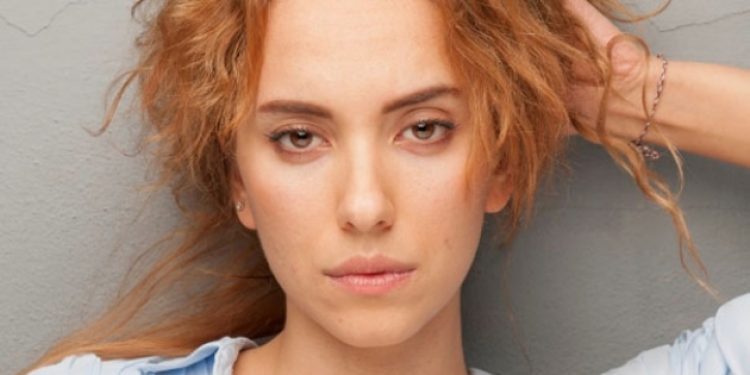 Duygu Sarışın’ın yüzü yandı