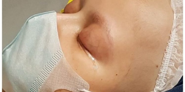 OHAL’le babası hapse giren Eray kanser tedavisine cevap vermiyor..