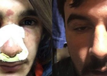 Çankırı’da Polisten uzun saç dayağı..