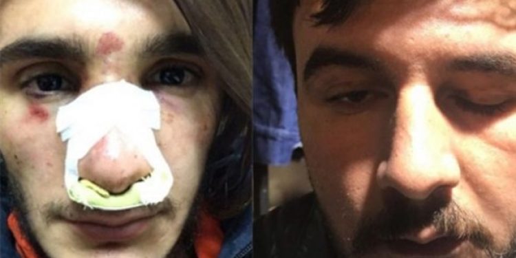 Çankırı’da Polisten uzun saç dayağı..