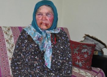 Gaspçı, 75 yaşındaki kadını bu hale getirdi