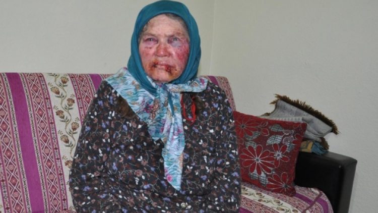 Gaspçı, 75 yaşındaki kadını bu hale getirdi