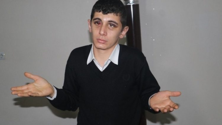 İşitme engelliyi döven 4 maganda tutuklandı