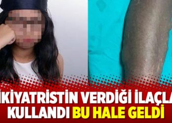 Psikiyatristin verdiği ilaçları kullandı bu hale geldi