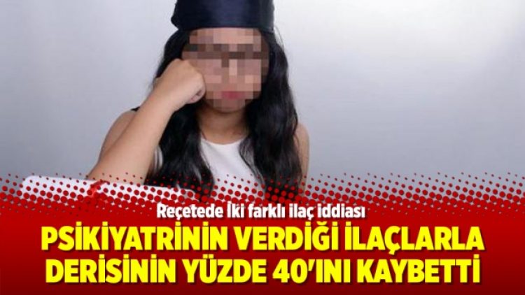 Psikiyatrinin verdiği ilaçlarla derisinin yüzde 40’ını kaybetti