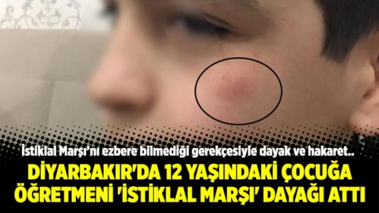 Diyarbakır’da 12 yaşındaki çocuğa öğretmeni ‘İstiklal Marşı’ dayağı attı