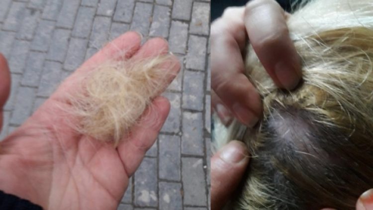 Polis eylemcinin saçını yoldu