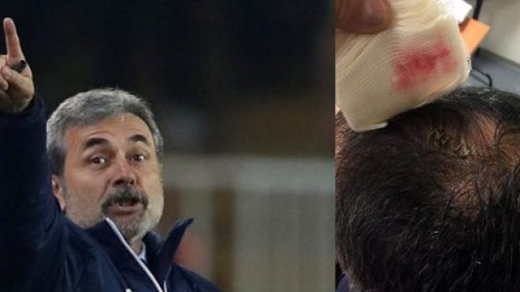 Aykut Kocaman’dan Şenol Güneş’e: Ben kan görmedim, kan nerede?