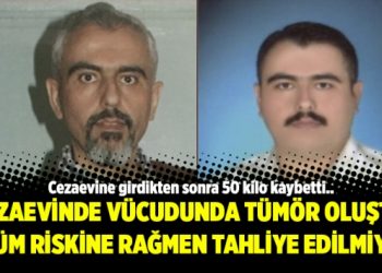 Cezaevinde vücudunda tümör oluştu; ölüm riskine rağmen tahliye edilmiyor