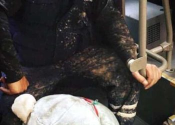 ‘Kirli oyuncak ayı’nın hikayesi: Torunlarım sevindi, ben ağladım