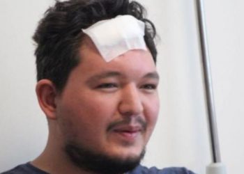 Başında parke taşı kırılan doktor konuştu