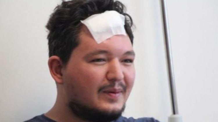 Başında parke taşı kırılan doktor konuştu