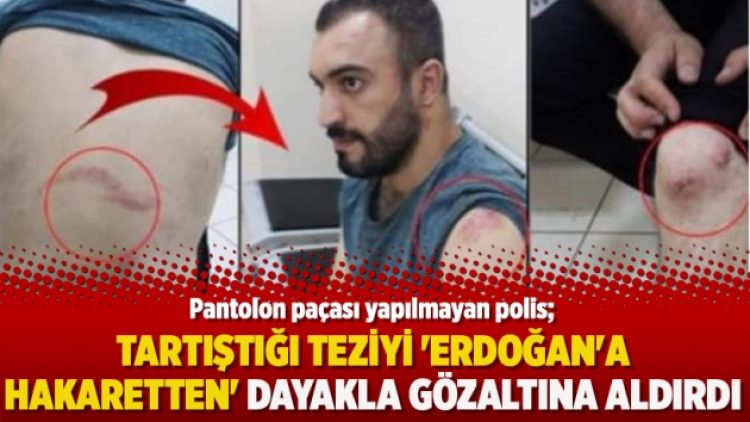 Pantolon paçası yapılmayan polis, tartıştığı teziyi ‘Erdoğan’a hakaretten’ dayakla gözaltına aldırdı