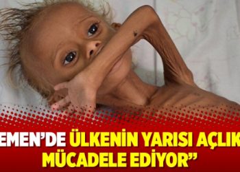 Yemen’de ülkenin yarısı açlıkla mücadele ediyor
