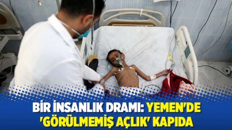 Bir insanlık dramı: Yemen’de ‘görülmemiş açlık’ kapıda