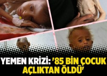 Yemen krizi: ’85 bin çocuk açlıktan öldü’