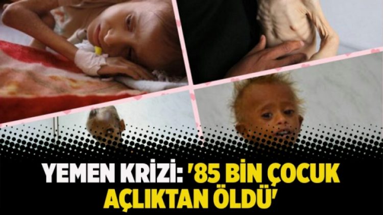 Yemen krizi: ’85 bin çocuk açlıktan öldü’