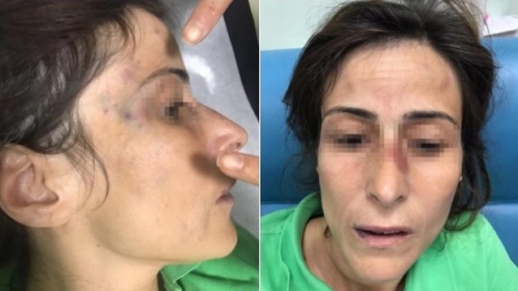 Eşinin kemiklerini kıran doktora ‘takdir indirimi’