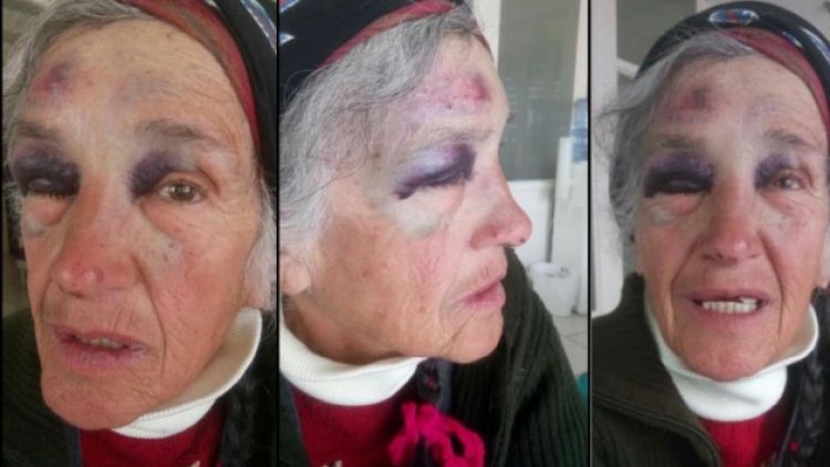 Perihan Pulat’ı darp eden polis: Uzaklaştırmak için ittim